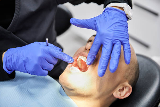Best Emergency Tooth Extraction in Fairmount Heights, MD